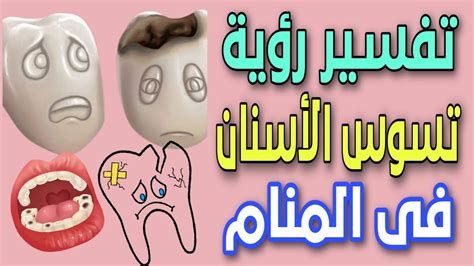 تفسير ألم الأسنان في المنام وجع الأضراس في الحلم