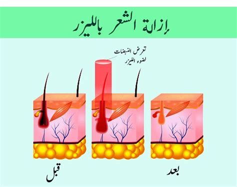 تجربتي مع التردد الحراري