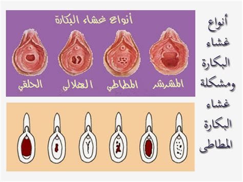 أين تقع فتحة الغشاء الهلالي