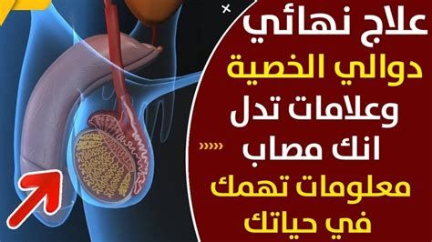 ألم الخصية اليسرى أسفل البطن