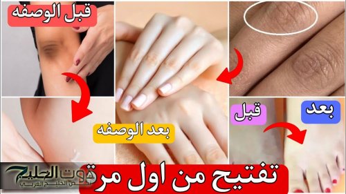 5 مكونات سحرية لتبييض فوري وسريع لليدين وعقل الأصابع من أول استعمال