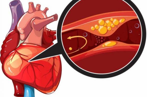 هذه الـ 5 الفئات الأكثر عرضة للإصابة بمرض الشريان التاجي.. هل انت بينهم؟