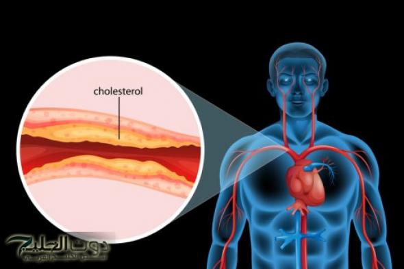 كيف تسهم الأغذية في تخفيض مستوى الكوليسترول في الدم